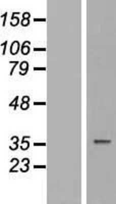 Western Blot: TUSC3 Overexpression Lysate [NBP2-09836]