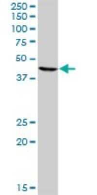 Western Blot: TUSC4 Antibody [H00010641-B02P]