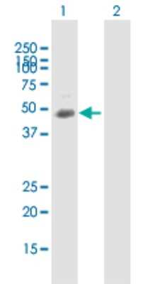 Western Blot: TUSC4 Antibody [H00010641-B02P]