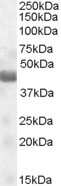 Western Blot: TUSC4 Antibody [NB100-93442]