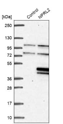 Western Blot: TUSC4 Antibody [NBP1-82537]