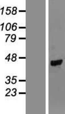 Western Blot: TUSC4 Overexpression Lysate [NBL1-17456]