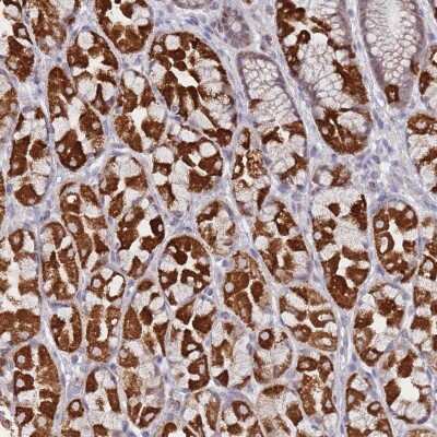 Immunohistochemistry: TUSC5 Antibody [NBP2-48982]