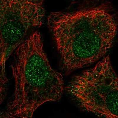 Immunocytochemistry/ Immunofluorescence: TUT1 Antibody [NBP2-56631]