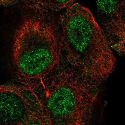 Immunocytochemistry/ Immunofluorescence: TUT1 Antibody [NBP2-57861]