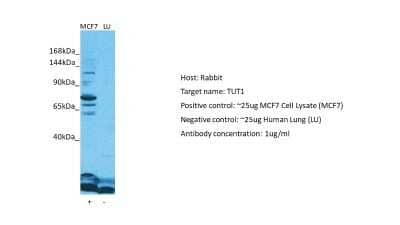 Western Blot: TUT1 Antibody [NBP2-86028]