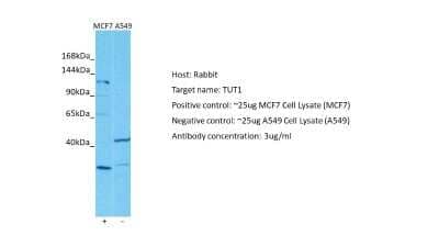 Western Blot: TUT1 Antibody [NBP2-86030]