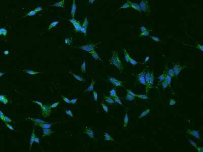 Immunocytochemistry/ Immunofluorescence: TVP23A Antibody [NBP2-98146]