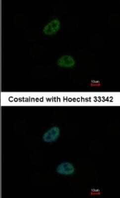 Immunocytochemistry/ Immunofluorescence: TWA1 Antibody [NBP1-32596]