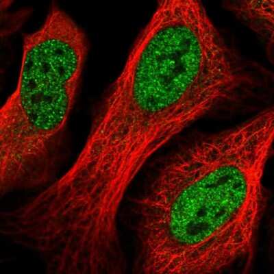 Immunocytochemistry/ Immunofluorescence: TWA1 Antibody [NBP2-55320]