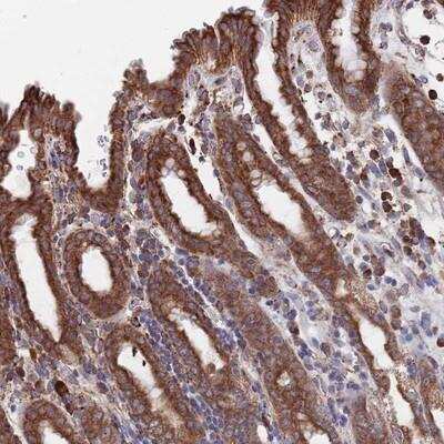 Immunohistochemistry-Paraffin: TWA1 Antibody [NBP2-14397]