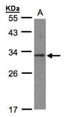 Western Blot: TWA1 Antibody [NBP1-32596]