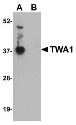 Western Blot: TWA1 AntibodyBSA Free [NBP1-77366]