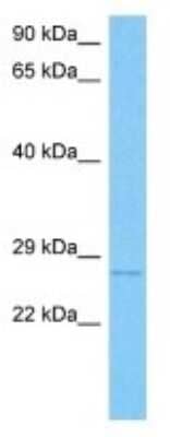 Western Blot: TWA1 Antibody [NBP3-10061]