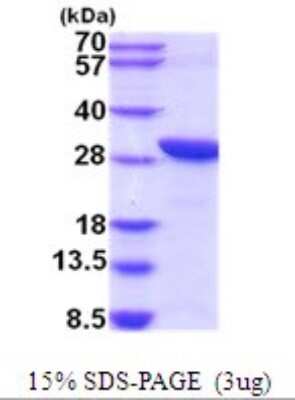 SDS-PAGE: Recombinant Human TWA1 His Protein [NBP2-52076]