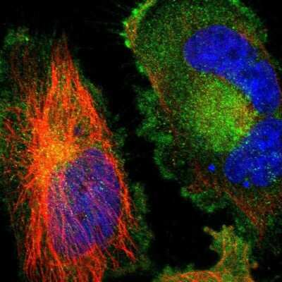 Immunocytochemistry/ Immunofluorescence: TWEAK R/TNFRSF12 Antibody [NBP1-85770]