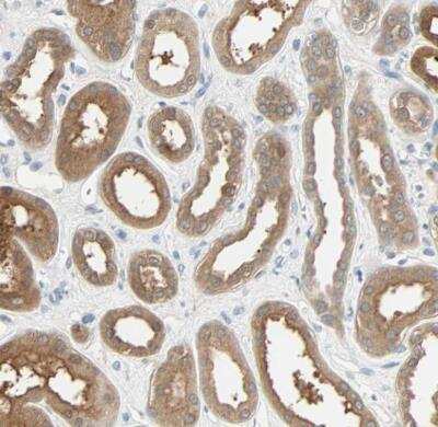 Immunohistochemistry-Paraffin: TWEAK R/TNFRSF12 Antibody [NBP1-85770]