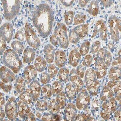Immunohistochemistry-Paraffin: TWEAK R/TNFRSF12 Antibody [NBP1-85770]