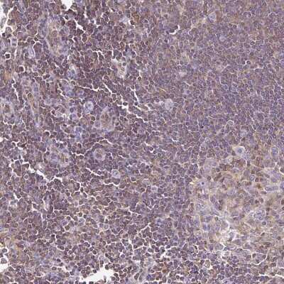 Immunohistochemistry-Paraffin: TWF2 Antibody [NBP2-47591]