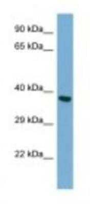 Western Blot: TWF2 Antibody [NBP1-98388]