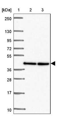 Western Blot: TWF2 Antibody [NBP2-47591]