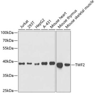 Western Blot: TWF2 AntibodyBSA Free [NBP2-94467]