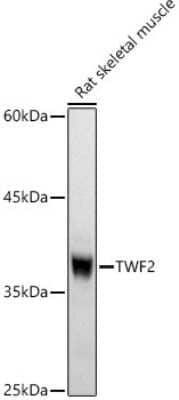 Western Blot: TWF2 AntibodyAzide and BSA Free [NBP2-94579]