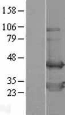 Western Blot: TWF2 Overexpression Lysate [NBL1-17459]