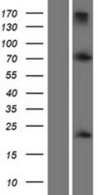 Western Blot: Twist-1 Overexpression Lysate [NBP2-09027]