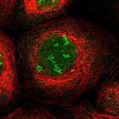 Immunocytochemistry/ Immunofluorescence: TWISTNB Antibody [NBP1-89449]