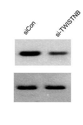 Western Blot: TWISTNB Antibody [NBP1-89449]