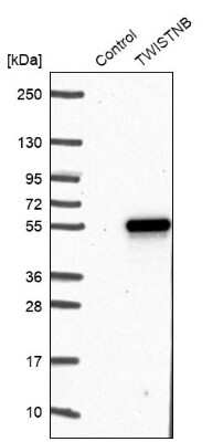 Western Blot: TWISTNB Antibody [NBP1-89449]