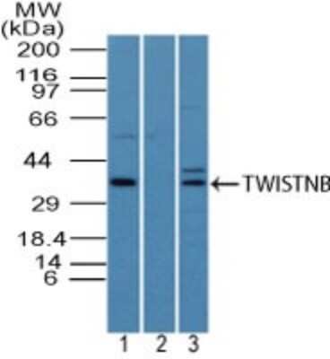 Western Blot: TWISTNB Antibody [NBP2-27081]