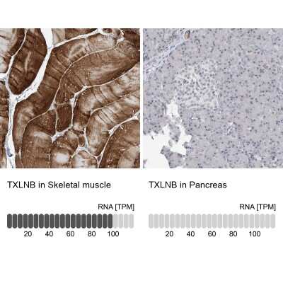 Immunohistochemistry-Paraffin: TXLNB Antibody [NBP1-91161]