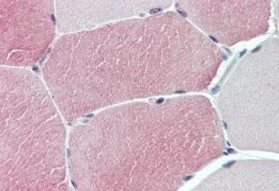 Immunohistochemistry-Paraffin: TXLNB Antibody [NBP3-14510]