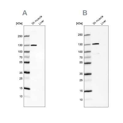 Western Blot: TXLNB Antibody [NBP2-33926]