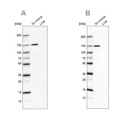 Western Blot: TXLNB Antibody [NBP2-33927]