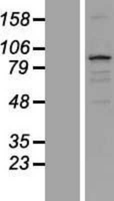 Western Blot: TXLNB Overexpression Lysate [NBP2-05277]