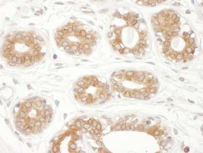 Immunohistochemistry: TXNDC Antibody [NBP2-22328]
