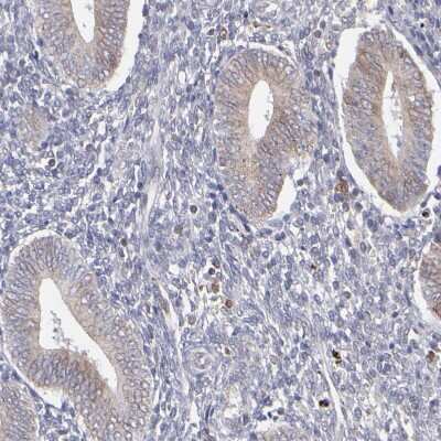 Immunohistochemistry-Paraffin: TXNDC Antibody [NBP1-87306]