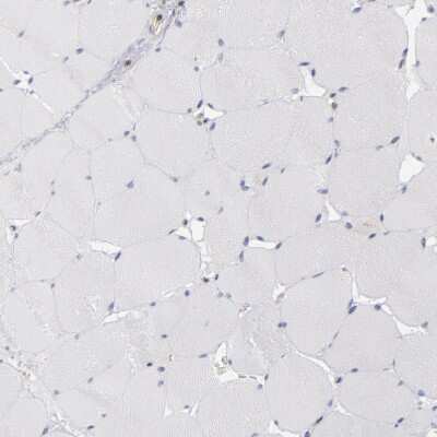 Immunohistochemistry-Paraffin: TXNDC Antibody [NBP1-87306]