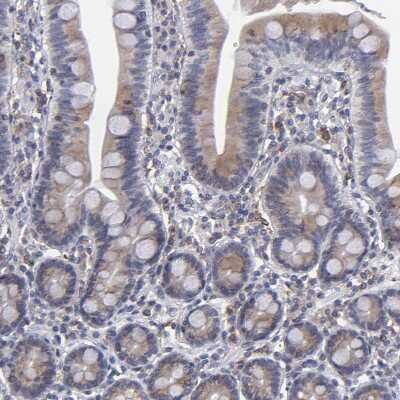 Immunohistochemistry-Paraffin: TXNDC Antibody [NBP1-87306]