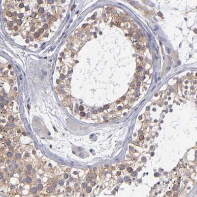 Immunohistochemistry-Paraffin: TXNDC Antibody [NBP1-87306]