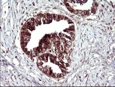 Immunohistochemistry: TXNDC Antibody (OTI3H5) - Azide and BSA Free [NBP2-74725]