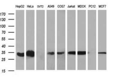 Western Blot: TXNDC Antibody (OTI3H5)Azide and BSA Free [NBP2-74725]