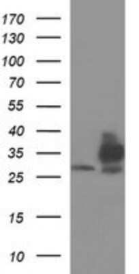 Western Blot: TXNDC Antibody (OTI3H5)Azide and BSA Free [NBP2-74725]