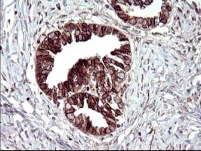 Immunohistochemistry: TXNDC Antibody (OTI3H5) [NBP2-46143]