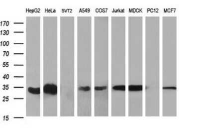 Western Blot: TXNDC Antibody (OTI3H5) [NBP2-46143]
