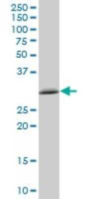 Western Blot: TXNDC Antibody [H00081542-B01P]