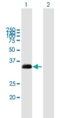 Western Blot: TXNDC Antibody [H00081542-B01P]